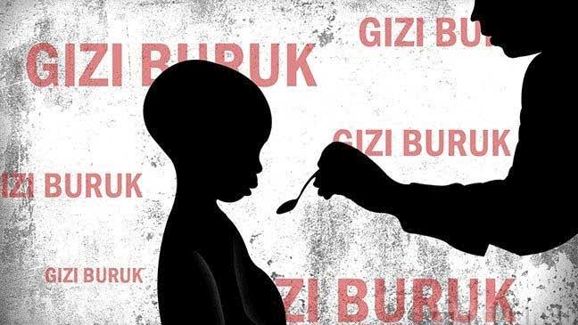 Masalah Gizi Buruk Meningkat Saat Pandemi